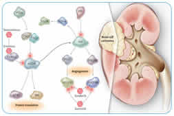 laser holmium lithotripsy advantages endoscopic techniques